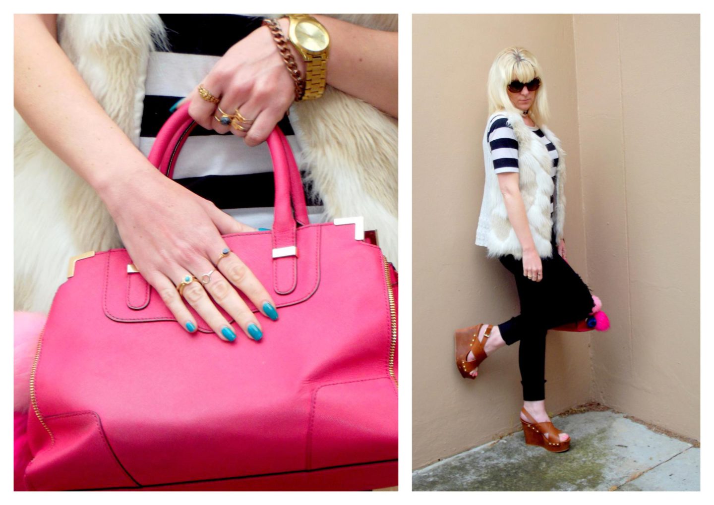 striped-rebecca-minkoff-1